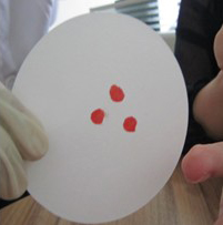 Blood stain sampling method