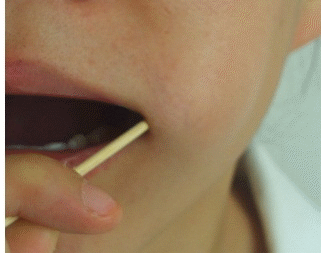 Oral swab sampling method